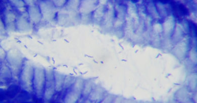 Hélicobacter Pylori