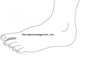 Emplacement du point "Xing Jian": À l'intérieur du gros orteil, entre le gros orteil et le deuxième orteil.