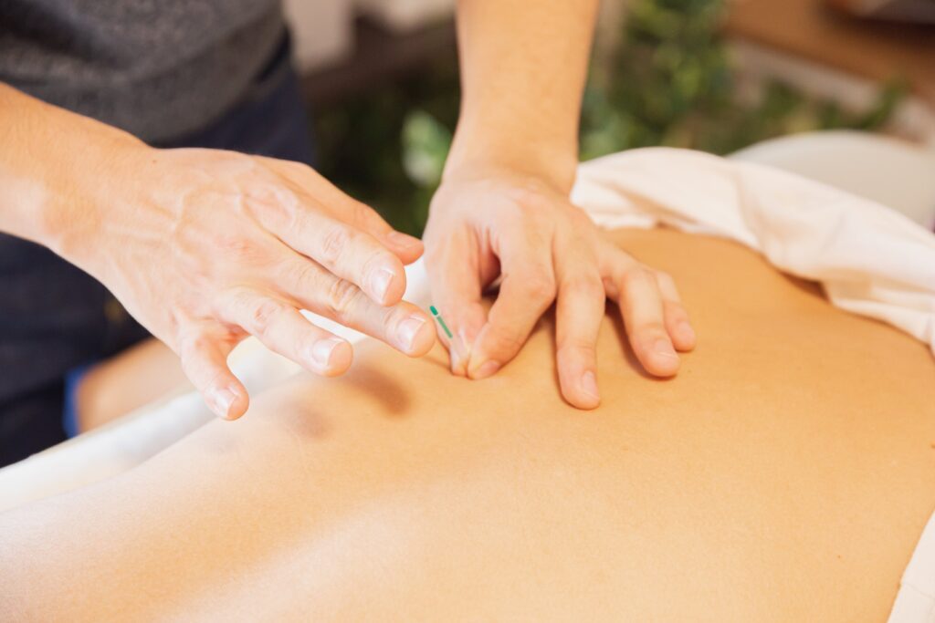 La cupping thérapie et l'acupuncture fonctionnent en synergie pour restaurer l'harmonie énergétique du corps et favoriser la guérison.